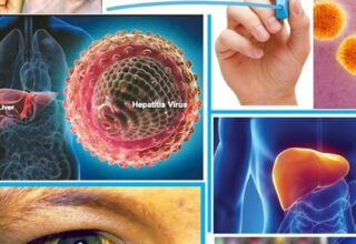 ہیپاٹائٹس سی